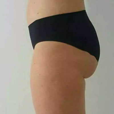 Glutes Workout, Butt Lift, Toning & Firm,ing